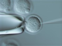Obraz spod mikroskopu manipulacyjnego przedstawiający mikroiniekcję DNA do przedjądrza zapłodnionej komórki jajowej myszy: